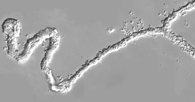 Bild eines mikrodissezierten Sammelrohrs aus der Mausniere