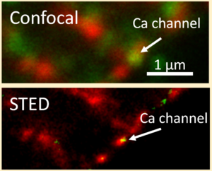 Immunfluoreszenzanalyse der Ca2+-Kanalexpression mit konfokaler und STED-Mikroskopie in einer Kardiomyozyte