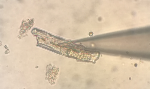 Isolated human ventricular cardiomyocyte during patchclamp recording