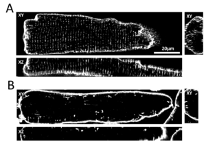 Fig. 2: A 3D confocal microscopic image of the t-system in a cardiomyocyte. B Cardiomyocyte with loss of t-system, e.g. in heart failure