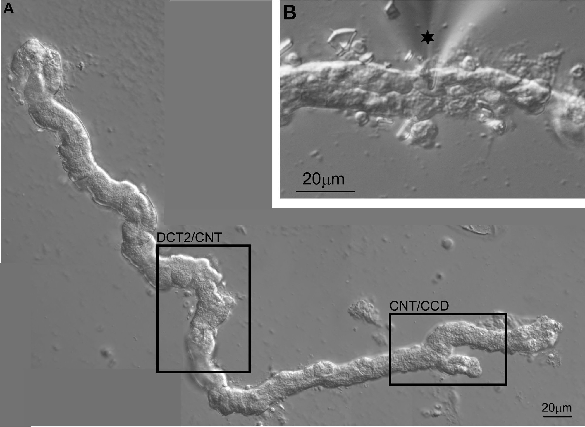 Differential interference contrast image microdissected distal mouse nephronTransitional zone between the distal convoluted tubule and early connecting tubule (DCT2/CNT) and the zone comprising the late CNT and early CCD (CNT/CCD) are indicated. B Split open tubule with patch pipette (*)