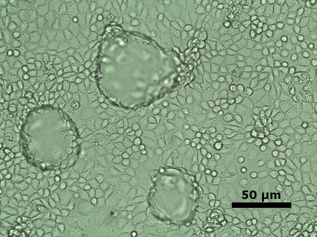 Phase contrast micrograph of cultured collecting duct cells (mCCDcl1 cell line) with dome formation indicating active transepithelial electrolyte and fluid transport